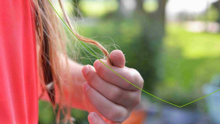 Haaruitval en kale plekken bij vrouwen